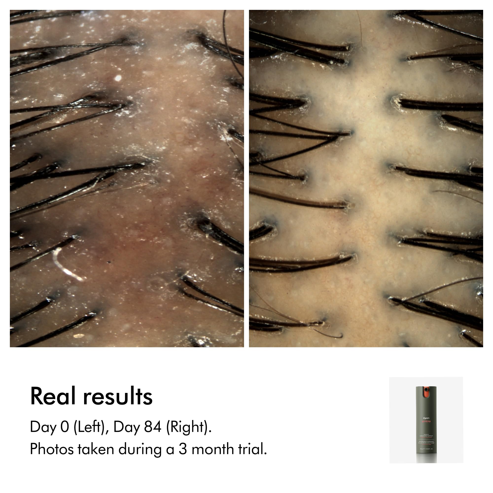 dyson-amino-leave-in-scalp-bubble-treatment image 8